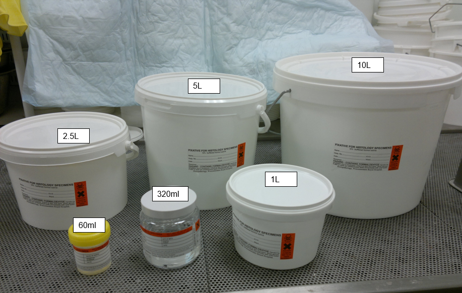 The size of the specimen container must be appropriate to the size of the specimen.

Small specimens  –  Yellow/Orange Topped 60 mL Containers for biopsies and small resection e.g. skin ellipses, appendicies
Routine specimens  – 350 mL White Topped “Honey Pots” – Suitable for larger specimens e.g. gall bladder, appendix, larger skin resections, femoral heads.
Large resection specimens  – 1L/2.5L/5L and 10 L specimen buckets pre-filled with fixative are available for larger specimens.  e.g. bowel, uterus, breast tissue.
“Mega” Specimen Buckets  –  The buckets should be collected from cellular pathology in advance of the surgery taking place.

