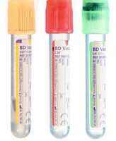 SST, Plain or Lithium Heparin
