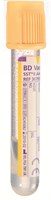 Adults: 5ml Serum SST (gold top)
Paediatrics: 0.5ml lithium/heparin (orange top)
