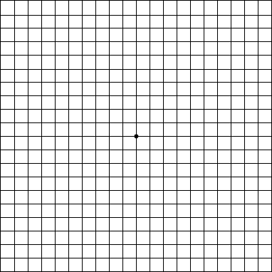 Image of an Amsler Grid