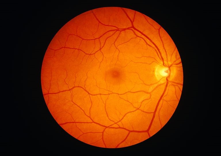 Image of a healthy retina of an eye