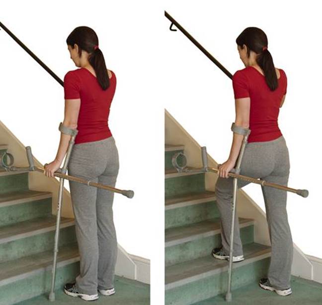 Image of person moving up stairs  using one crutch holding banister with one hand and other crutch horizontally in same had as crutch being used