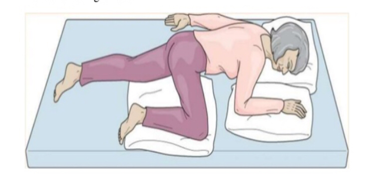 Diagram of person lying prone on their front. Head on pillow. One arm positioned at 90 degrees by head supported on pillow. One arm straight by side, One knee the same side as the supported arm is at 90 degrees supported by a pillow. Other leg is straight. 