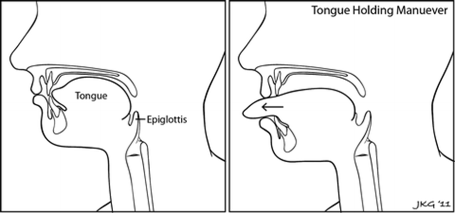 Anatomical diagram of side view of  mouth and throat showing tongue and epiglottis
Second anatomical diagram of side view of  mouth and throat showing tongue poking out of mouth