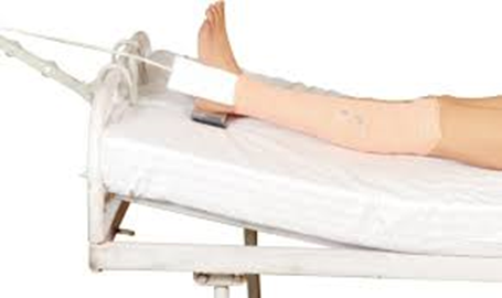 Person with left leg in skin traction