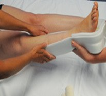 Person with skin traction support being applied to right leg
