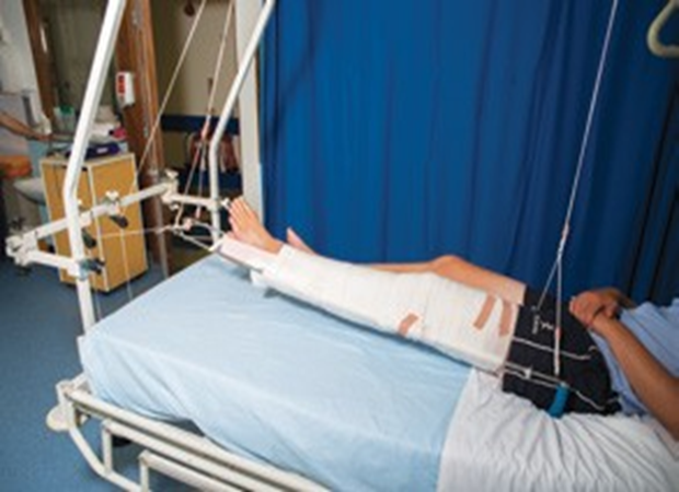 Person laid on bed with fully bandaged left leg raised in traction by pulley system