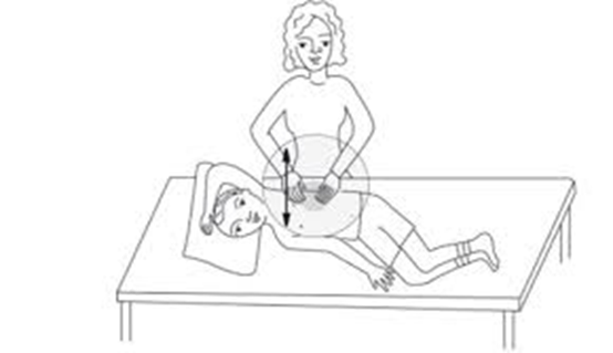 diagram of person receiving cupped hand drumming to side of chest