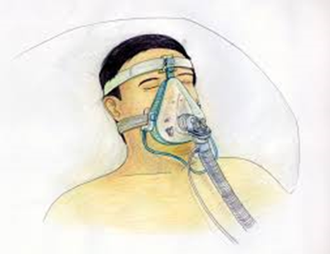Diagram of person asleep wearing mask and head strap