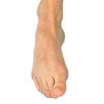 Toes being pushed down