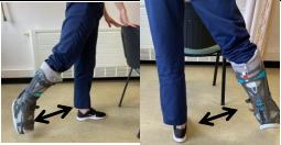 Leg exercises injured leg straight back, to the side, back in