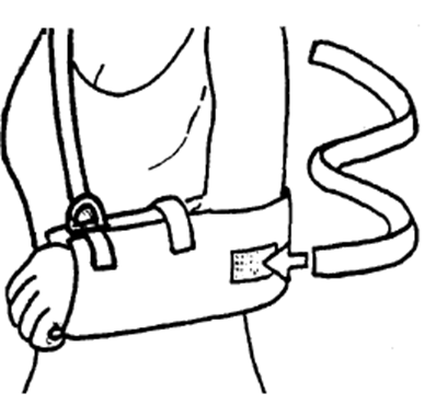 Image of body strap attached with hook and loop fastener