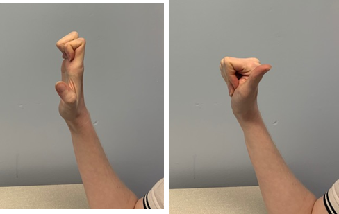 An image of a hand with fingers bent tightly but palm is open and thumb is extended. A second image is of fingers bent to close the palm, thumb is still extended. 