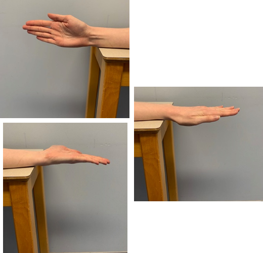An image of a hand resting on it's side on a table with the thumb and fingers straight, palm facing out. A second image shows the arm rotated so the palm faces down. A third image shows the palm rotated so the palm faces up.
