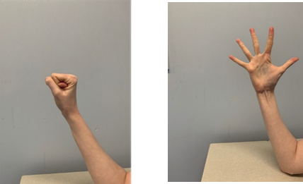 Image shows a hand in a fist and a second image shows a hand with fingers stretched wide apart. Elbow is resting on a table