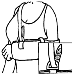 Diagram of arm in sling with inset of fixing
