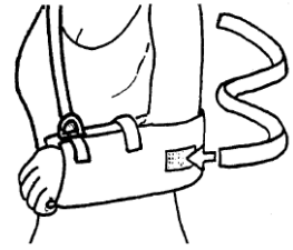 Diagram of arm in sling showing waist strap