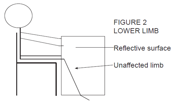 A diagram of a (stick) individual sat on a chair holding a mirror in front of their affected lower limb (leg)