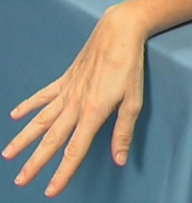 Image of arm rested on a table top with wrist at the edge so the hand can be moved up and down over edge 