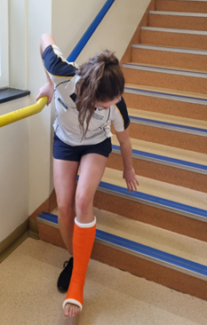 An individual in a leg plaster cast preparing to go up some stairs on their bum. they are using an hand rail for support to lower themselves onto the step 