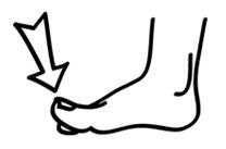 Diagram of foot with arrow pointing to big toe