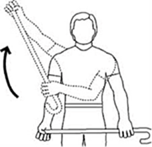 A diagram of a an individual using a (walking) stick to lift affected arm up and out to the side