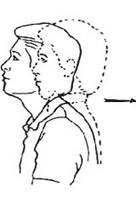 A diagram of the upper body side on view demonstrating a head and neck retracting backwards over spine
