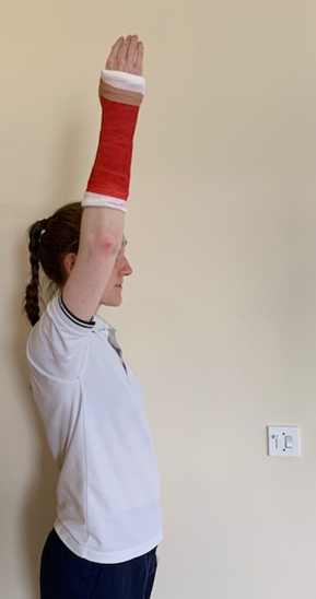 A person raising their right arm, which is in a cast, directly upwards.