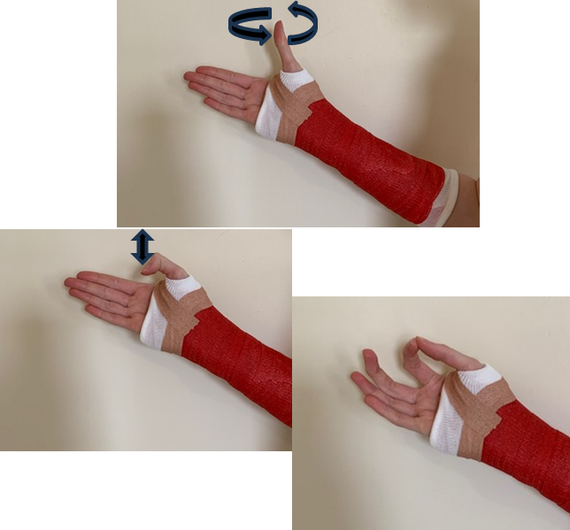 A hand in a cast flexing the thumb joints. Moving thumb in circles both ways and touching thumb to pointer finger