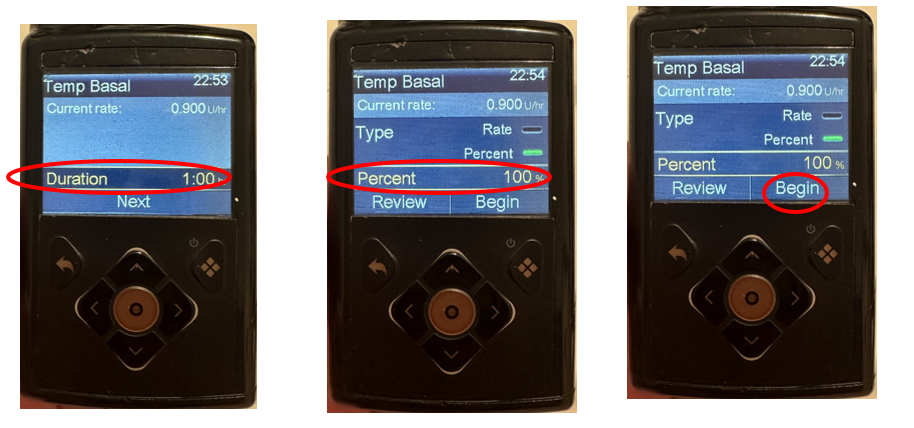 Image of three Medtronic 780G pump screens