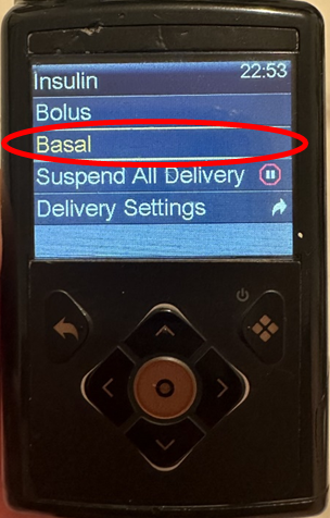Image of a Medtronic 780G pump screen with a red circle showing Basal