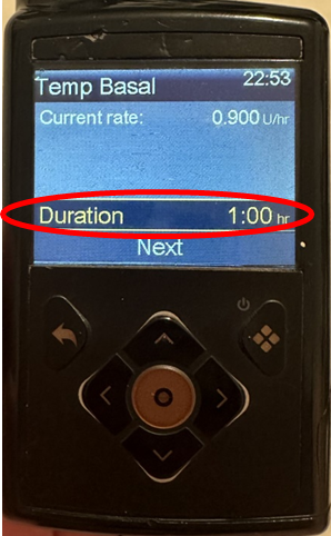 Photo of the Medtonic 780G screen, red circle shows duration