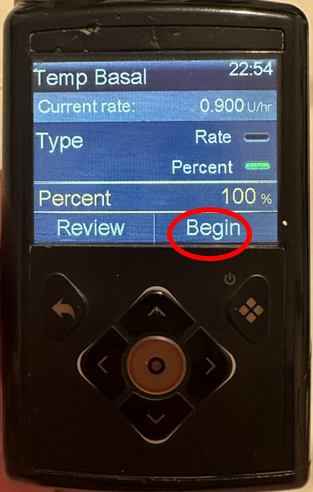 Photo of the Medtonic 780G screen, red circle shows begin
