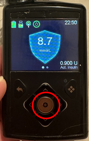 Photo of the Medtonic 780G screen, red circle shows circular button to select on the device in the centre