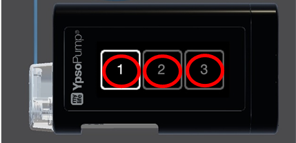 Photo of the Ypsomed CamAPS  screen, red circle shows 1,2 and 3