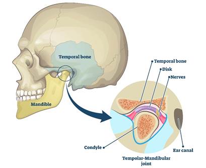 A view of the temporomandibular joint which is where lower and upper jaw ones join just under ear. An exploded diagram shows the specific body parts
