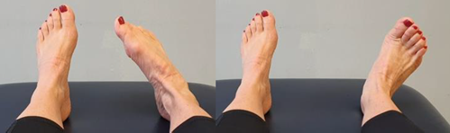 Feet with heels on bed toes pointing up, ankle flexed in and ankle flexed out