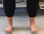Feet with toes raised off floor