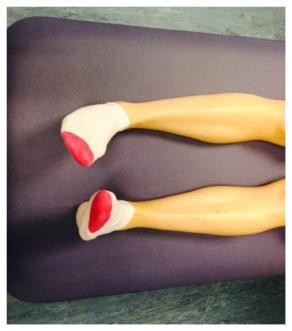 Lower legs flat on a bed with ankle being rotated and toes travelling round in a circle