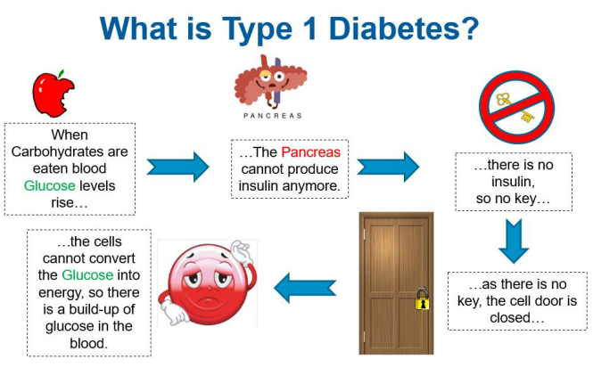 Image of flowchart which illustrates/explains what is type 1 diabetes