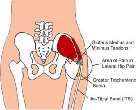 A front view of the hip parts including muscles, tendons and bones