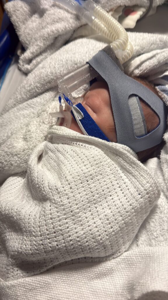 Thomas in Worcestershire Royal Hospital on a CPAP machine