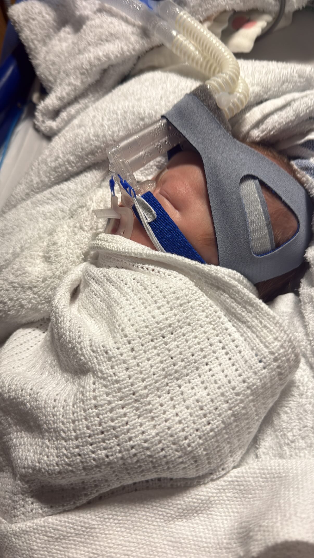 Thomas in Worcestershire Royal Hospital on a CPAP machine