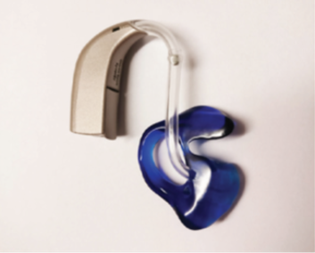 A photograph of the mould reattached to the hearing aid