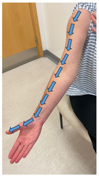 A photograph of a person's arm with arrows going downwards from the shoulder to the hand