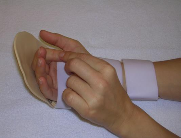 Picture of a hand in a splint, the index finger of other hand is gently and slowly pushing each finger down