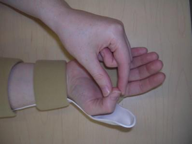 A picture with persons hand in a splint,   using the non-affected hand to bend the thumb towards the base of the little finger