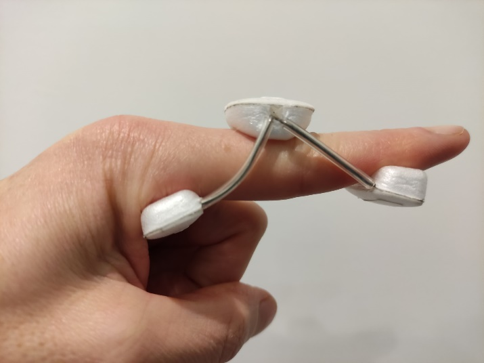 A picture of a persons finger with a finger extension splint