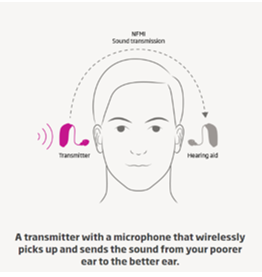 A drawing illustrating a transmitter from one side of the persons head is transmitting to the hearing aid on the other side of head