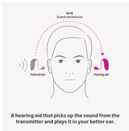 A drawing illustrating a hearing aid on one side of the head that picks up the sound from the transmitter on the other side of head